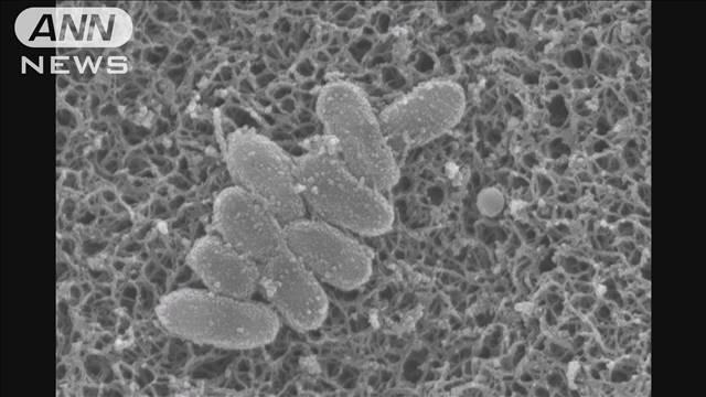 【速報】「百日せき」全国の感染者数は2176人　5週連続で過去最多を更新