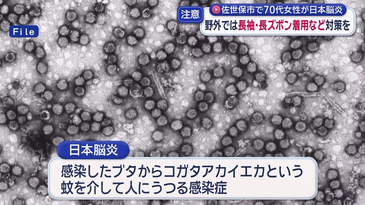 佐世保市で７０代女性が日本脳炎発症 野外では長袖・長ズボン着用など対策を