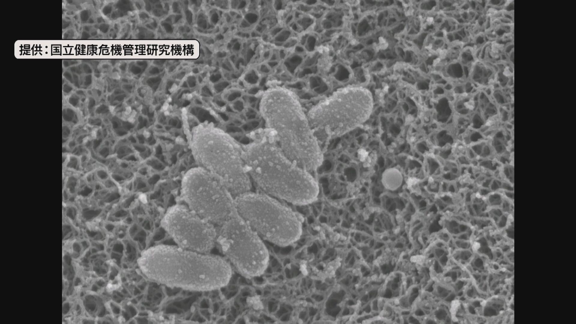 「百日せき」が過去最多を更新 県内累計で８５件発症