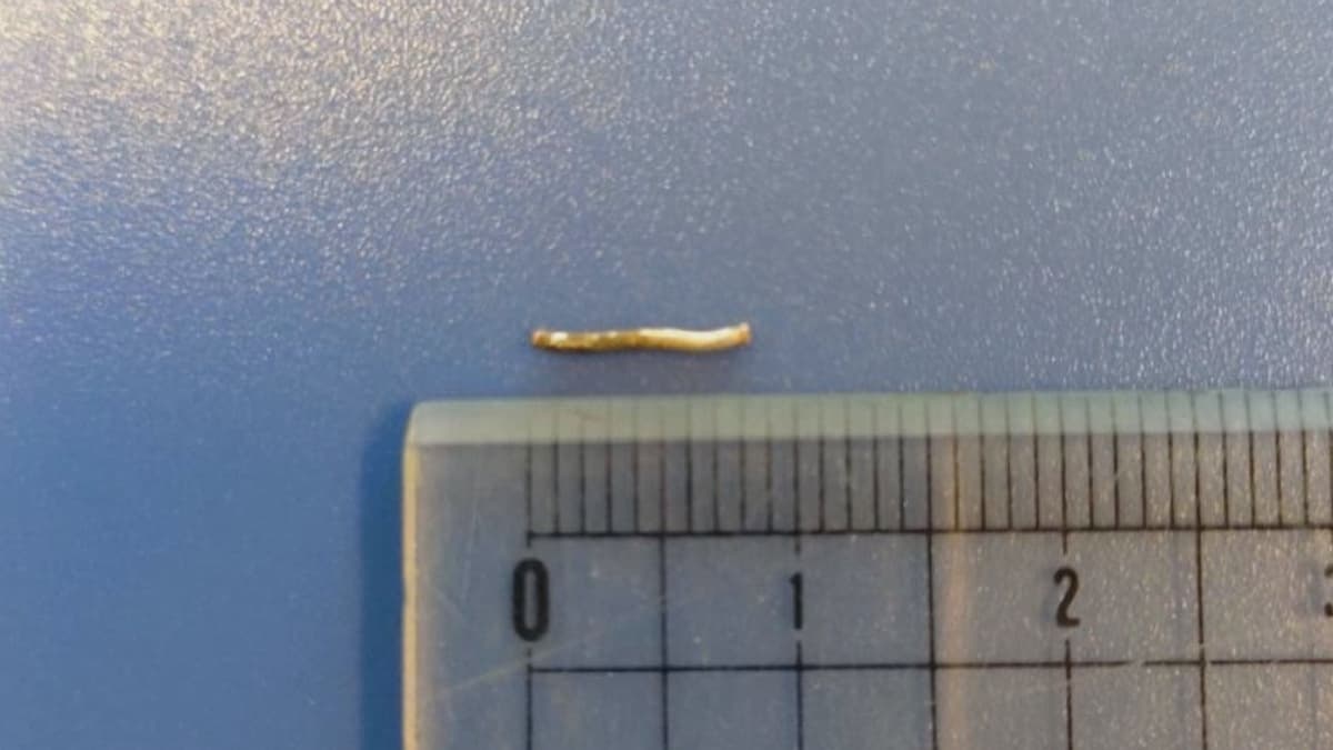 0210給食に金属片　今年度5回目