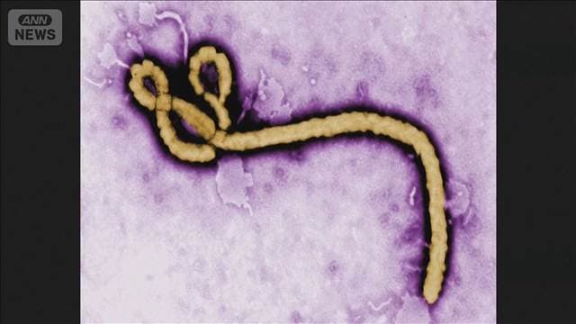 エボラ出血熱に米国人1人が感染 CDCが入国制限も W杯代表の対策も検討